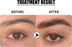 Flora Ruby - Wimper & Wenkbrauw Lifting Set 2 In 1 - Professionele 2 In 1 Lash Lift & Brow Lamination Kit - Permanente Wimperkruller 12 Flora Ruby - Wimper & Wenkbrauw Lifting Set 2 In 1 - Professionele 2 In 1 Lash Lift & Brow Lamination Kit - Permanente Wimperkruller -Make-Up Poeder Verkoop 1200x782 1