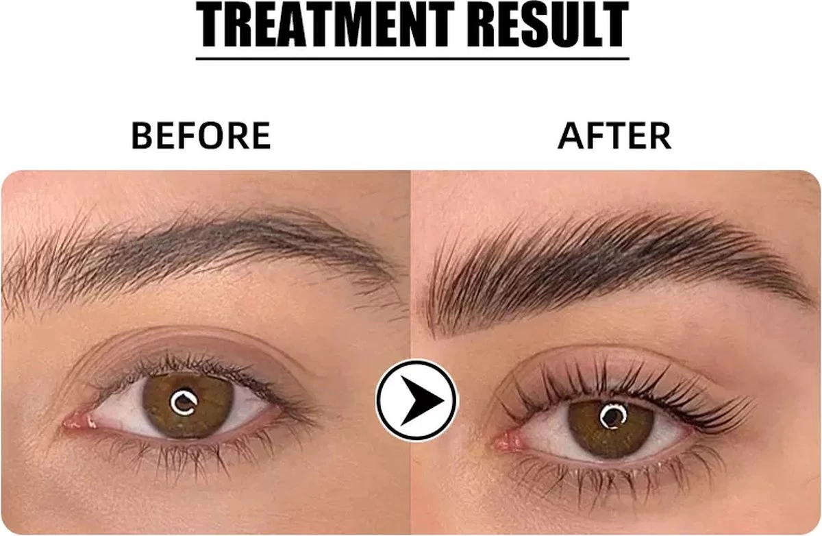 Flora Ruby - Wimper & Wenkbrauw Lifting Set 2 In 1 - Professionele 2 In 1 Lash Lift & Brow Lamination Kit - Permanente Wimperkruller 4 Flora Ruby - Wimper & Wenkbrauw Lifting Set 2 In 1 - Professionele 2 In 1 Lash Lift & Brow Lamination Kit - Permanente Wimperkruller - Afbeelding 4